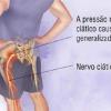 Massagem para dor no nervo ciatico - Vico Massagista e Quiropraxia - São José (SC)  #vicomassagista  @vicomassagista