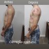 Correção postural 