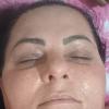 Limpeza facial 