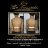 Correção Postural