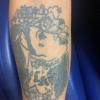 (Antes) Remoção de Tatuagem