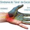Síndrome do túnel do carpo - tratamento com massagem - Vico Massagista e Quiropraxia - São José (SC)  #vicomassagista  @vicomassagista