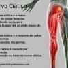 Dor no ciático - Massagem para dor no nervo ciático - Vico Massagista e Quiropraxia - São José (SC)  #vicomassagista