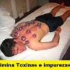 Massagem com ventosas - Vico Massagista e Quiropraxia - São José (SC)  #vicomassagista  @vicomassagista