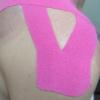 Kinesio tape