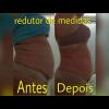 Redução de medidas
