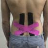 Aplicação de Bandagem Elástica funcional ( para analgesia) dor