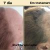 Tratamento para queda( Alopecia frontal)