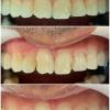 7• Antes e depois procedimento estético