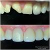5• Antes e depois procedimento estético