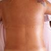Antes