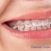 Ortodontistacuritiba