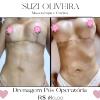 Suzi Oliveira Massoterapia E Estética