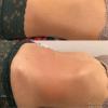 Rosileide Sabino Massoterapeuta