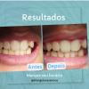 Odontologia Especializada Dr Angelo Casanova