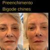 Preenchinento bigode chinês