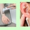 Laserterapia