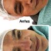Limpeza e revitalização