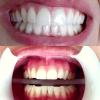 Drª Tatiana Caetano Dentista  Ortodontista  Odontopediatra  Prótese Dentária