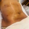 Caroline Albuquerque Especialista Em Massoterapia E Estética