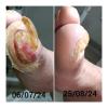 Home Care