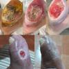 Home Care