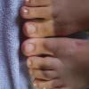 Depois pé feminino sem esmaltacao