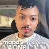 Você tem acne?