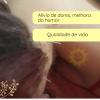 Acupuntura