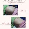 MODELAGEM LIPOFUNCIONAL