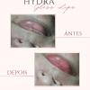 HYDRA GLOSS