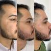 PROTOCOLO DE RECONSTRUÇÃO