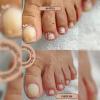 Pedicure