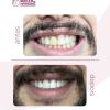 Núcleo By Akrs Smile