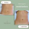 Antes e depois - massagem modeladora