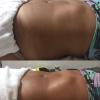Antes e depois 1 sessão