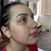 Antes