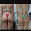 Massagem modeladora