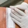 Curativo pós cirurgia