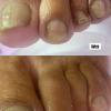 Jaque Cruz Unhas