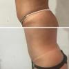 Massagem modeladora