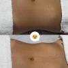 Massagem redutora