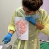 Carimbo de placenta