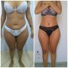 Massagem modeladora
