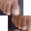 Pedicure somente com cutilagem, unhas limpas e saudáveis