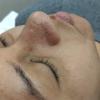 Trabalho facial/limpeza de pele profunda