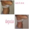 Antes e depois 