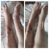 veja o antes e depois de uma drenagem linfática.