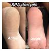SPA dos pés
