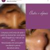 Antes e depois de limpeza de pele profunda